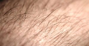 MahaChem Hair Loss