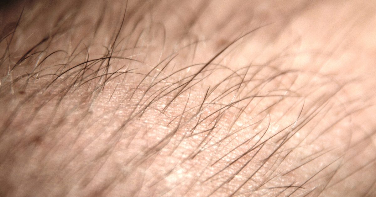 MahaChem Hair Loss