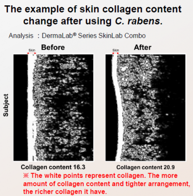 Collagen Content Increase 2